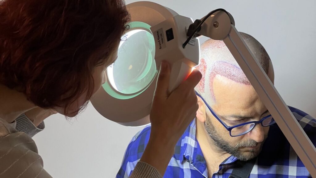 Hair transplant prices in turkey.